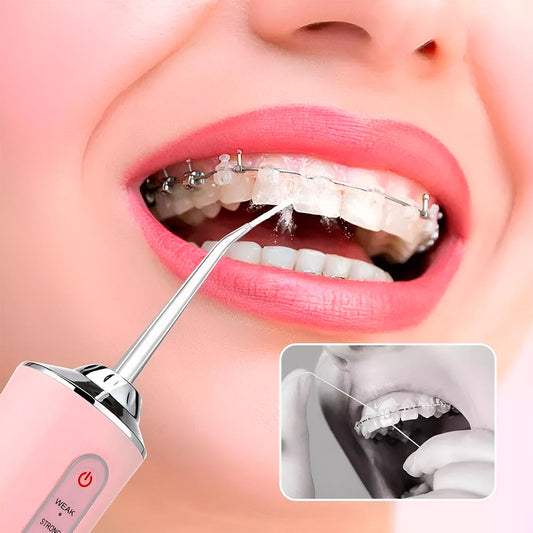 🦷✨ Higiene Dental Avanzada con Irrigador Bucal Recargable 💧🔋